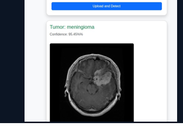 Brain Tumor Detection